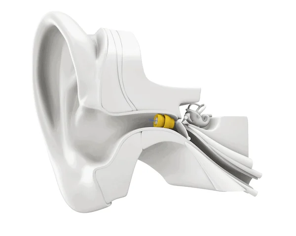 Phonak Lyrics hearing aid